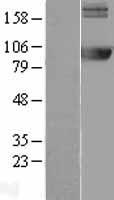 AMPD2 Human Over-expression Lysate