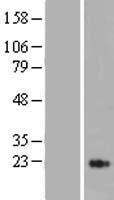 MASP2 Human Over-expression Lysate