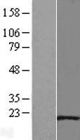 Hsp20 (HSPB6) Human Over-expression Lysate