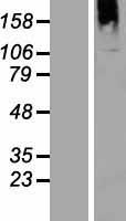BTBD16 Human Over-expression Lysate