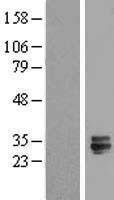 TMED6 Human Over-expression Lysate