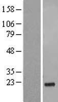GSG1L Human Over-expression Lysate