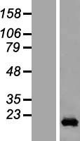 CCDC12 Human Over-expression Lysate