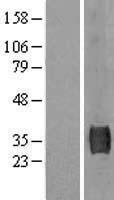 SUSD3 Human Over-expression Lysate