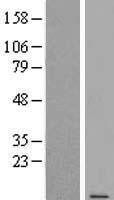 MHF2 (CENPX) Human Over-expression Lysate
