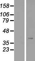 ANKRD23 Human Over-expression Lysate