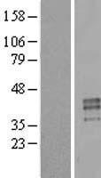PRSS21 Human Over-expression Lysate