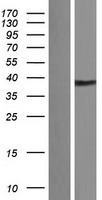 Kallikrein 11 (KLK11) Human Over-expression Lysate