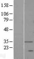 DEGS1 Human Over-expression Lysate