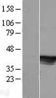 C6orf81 (ARMC12) Human Over-expression Lysate