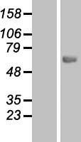 Carboxylesterase 7 (CES5A) Human Over-expression Lysate