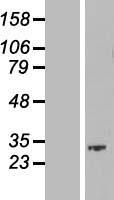 SKA1 Human Over-expression Lysate