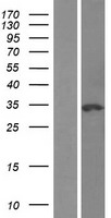 NSMCE1 Human Over-expression Lysate
