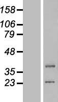 LIPT1 Human Over-expression Lysate