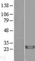 DIRAS1 Human Over-expression Lysate