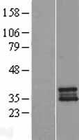 STOML3 Human Over-expression Lysate