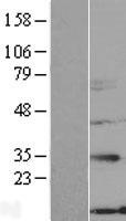 NXNL2 Human Over-expression Lysate
