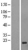 C1orf150 (GCSAML) Human Over-expression Lysate