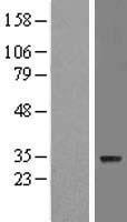 ZNF688 Human Over-expression Lysate