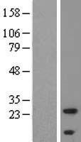 ALMS1P1 Human Over-expression Lysate