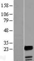 UBALD1 Human Over-expression Lysate