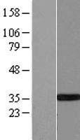 RDM1 Human Over-expression Lysate