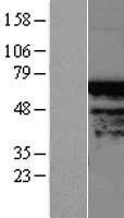 TIGD4 Human Over-expression Lysate
