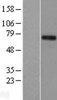 TIGD1 Human Over-expression Lysate