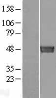 SEPTIN6 Human Over-expression Lysate