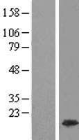 HMGA1 Human Over-expression Lysate