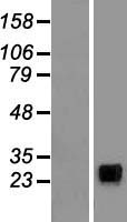 NCR3 Human Over-expression Lysate