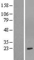 GSTM1 Human Over-expression Lysate