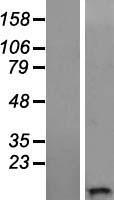 WFDC11 Human Over-expression Lysate