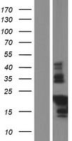 TMIE Human Over-expression Lysate