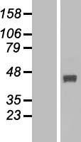 FBXO22 Human Over-expression Lysate
