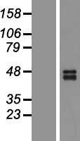 DR5 (TNFRSF10B) Human Over-expression Lysate