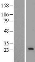 PEAMT (PEMT) Human Over-expression Lysate