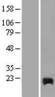 DPP1 (CTSC) Human Over-expression Lysate