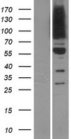 OSBPL9 Human Over-expression Lysate