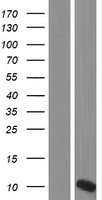 OTOS Human Over-expression Lysate