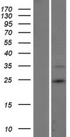 RNF185 Human Over-expression Lysate