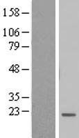BTF3L4 Human Over-expression Lysate