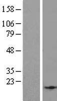 EID2B Human Over-expression Lysate