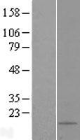 SNHG29 Human Over-expression Lysate