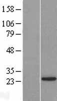 LSM12 Human Over-expression Lysate