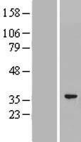 PACRG Human Over-expression Lysate