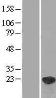 DUSP18 Human Over-expression Lysate