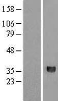 HORMAD2 Human Over-expression Lysate