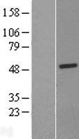 C13orf31 (LACC1) Human Over-expression Lysate