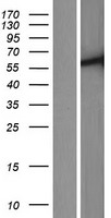 TTC39C Human Over-expression Lysate